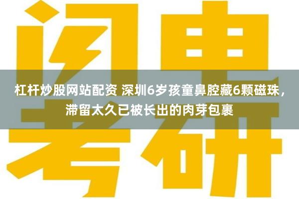 杠杆炒股网站配资 深圳6岁孩童鼻腔藏6颗磁珠，滞留太久已被长出的肉芽包裹